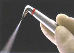 Recent Advances: Air Abrasion