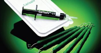 Recent Advances: Chemo-Mechanical Caries Removal (Carisolv)