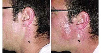 Sweating When Hungry?