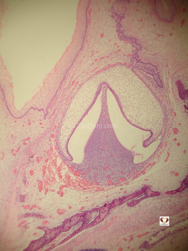 Late Bell Stage (21) OziDent
