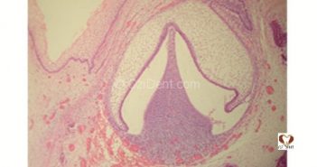 Tooth Development in Pictures