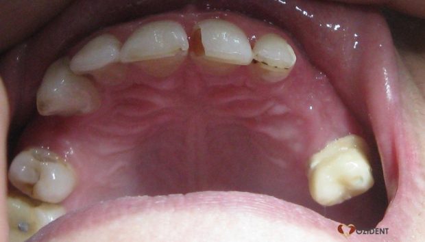 Occlusal view