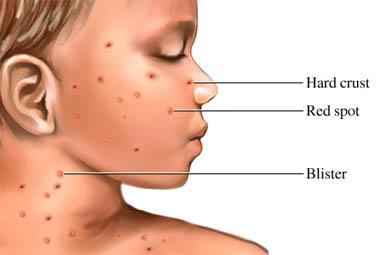 Skin Lesions