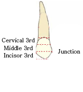 I = Incisor 3rd / M = Middle 3rd / J= Junction between I and M