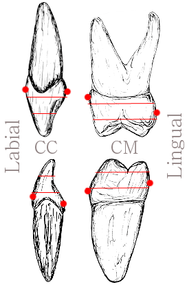 Side View ( C= Cervical 3rd / M = Middle 3rd) Side View ( C= Cervical 3rd / M = Middle 3rd)