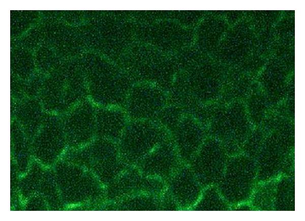 Direct immunofluorescence for deposits of IgG