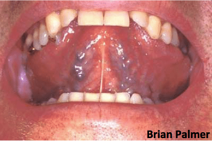 Tongue Position During the pronunciation of the Letter "N" 