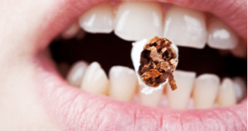 Smoking and Oral Health