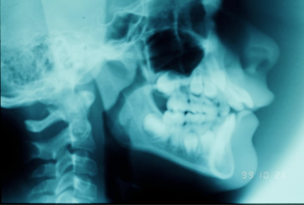 Radiographs before treatment