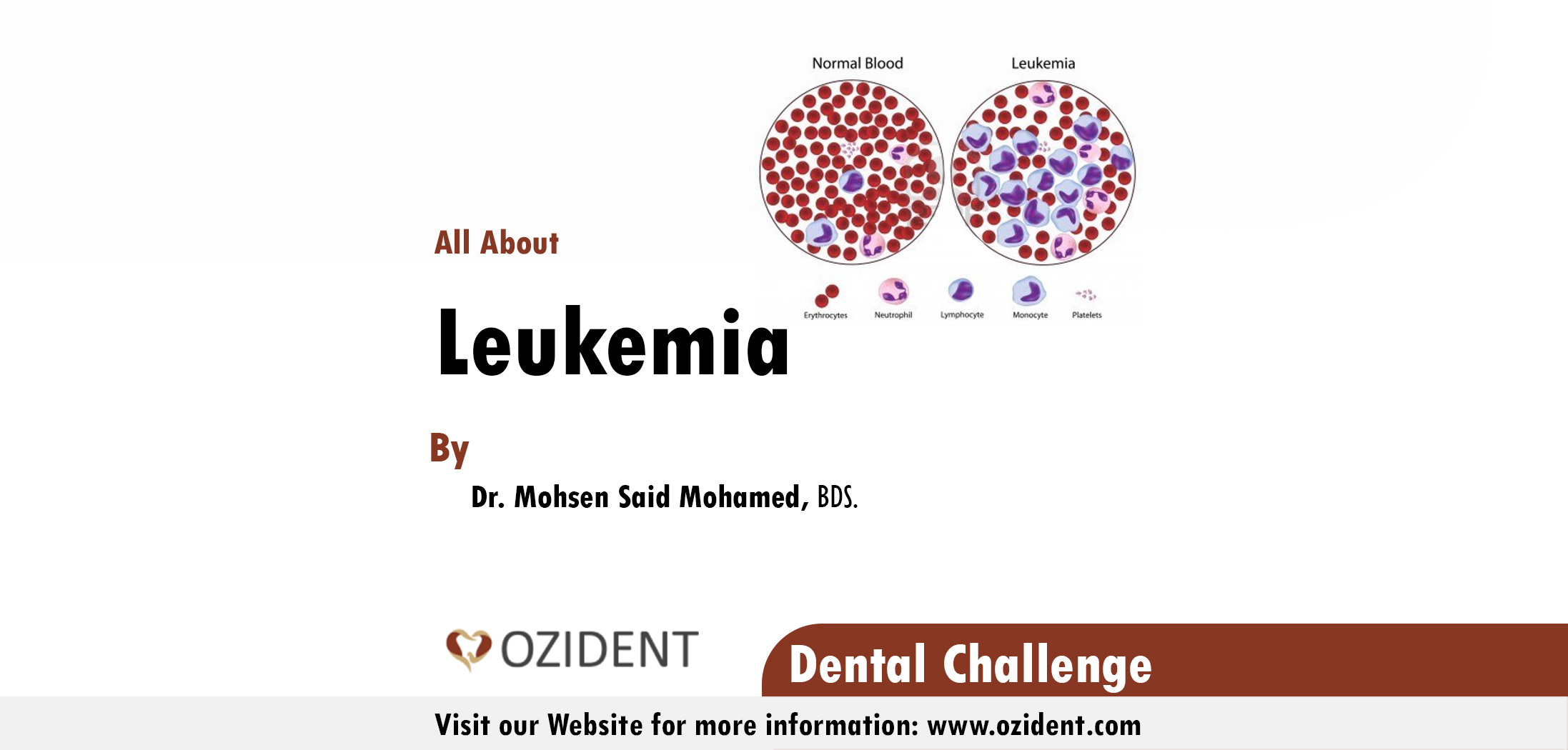 Dental Challenge Leukemia Management