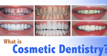 What is Cosmetic Dentistry?