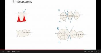 Video: Dental Anatomy – The Basics