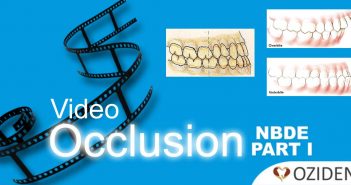 Video: Dental Occlusion for NBDE1