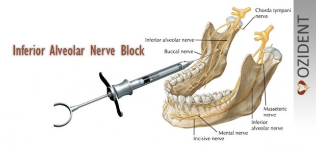 The Mandibular Nerve Block Anatomy The mandibular