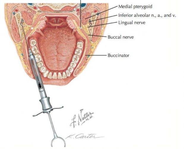 Sectional View