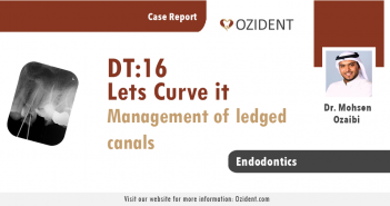 Case: DT16 – Lets Curve it