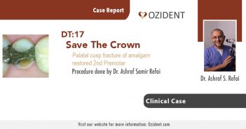 Case: DT17 – Save the Crown
