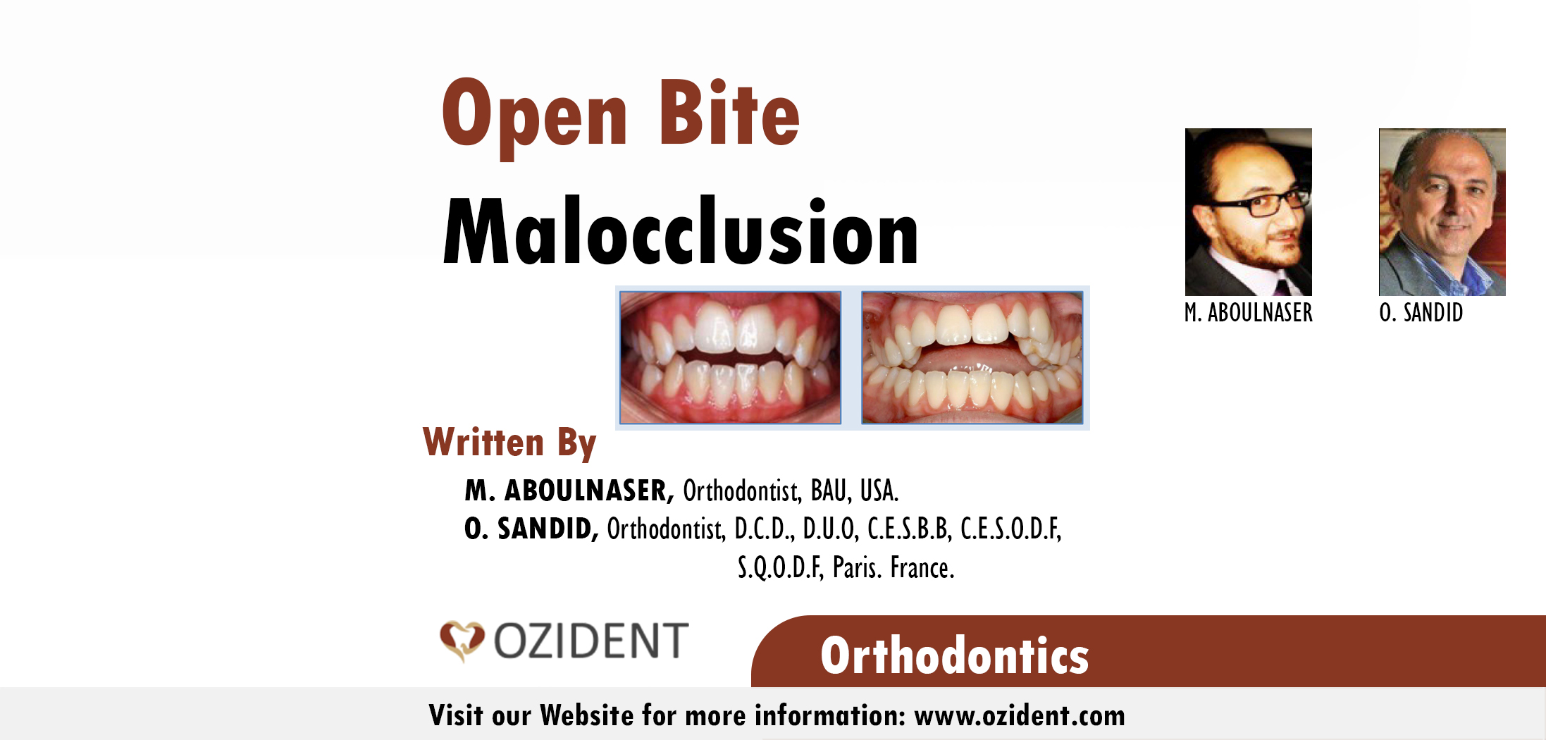 Open Bite Malocclusion OziDent