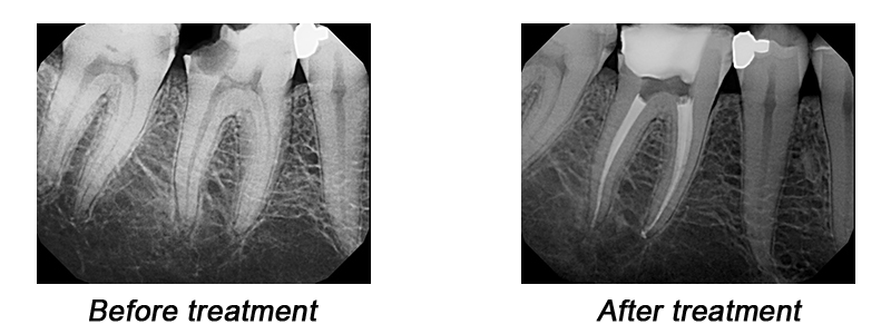 The patient can't always understand this example of successful treatment!